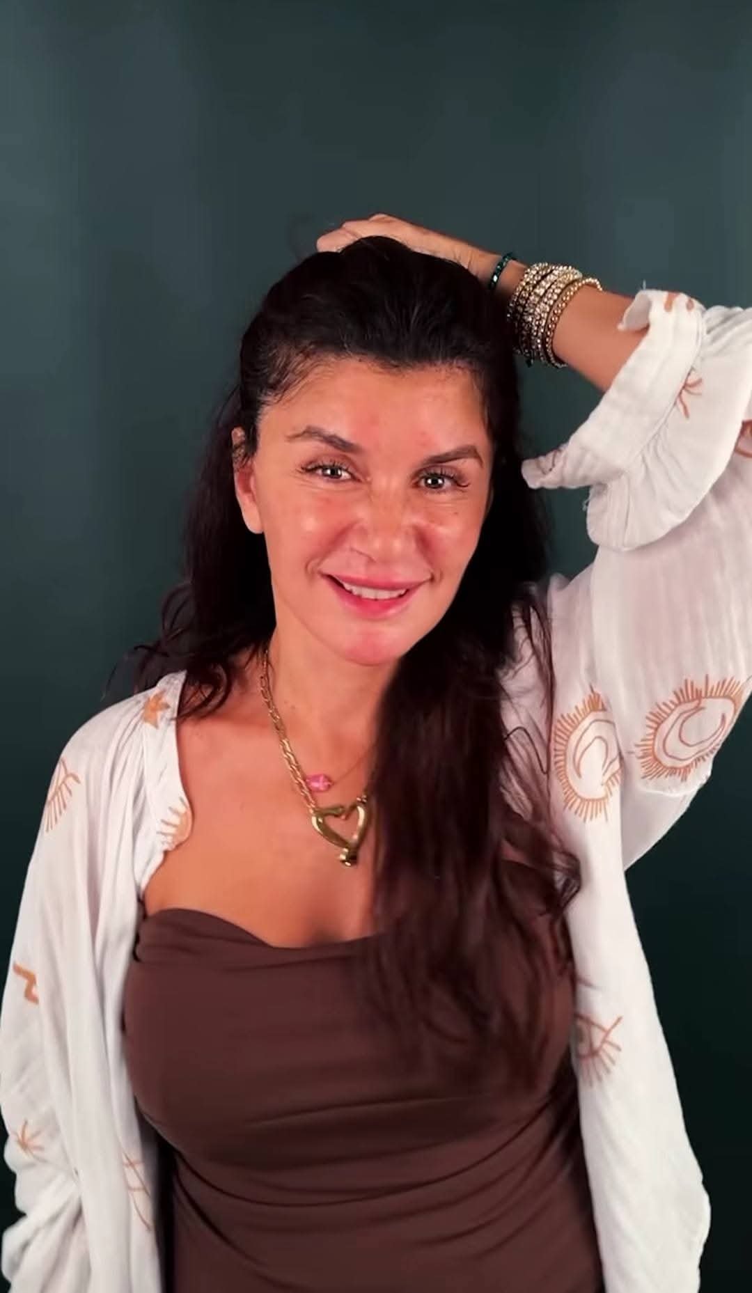 غادة عادل تكشف تفاصيل تجربة الـ"Facelift": رجعت 15 سنة و مبسوطة بالخطوة التجميلية